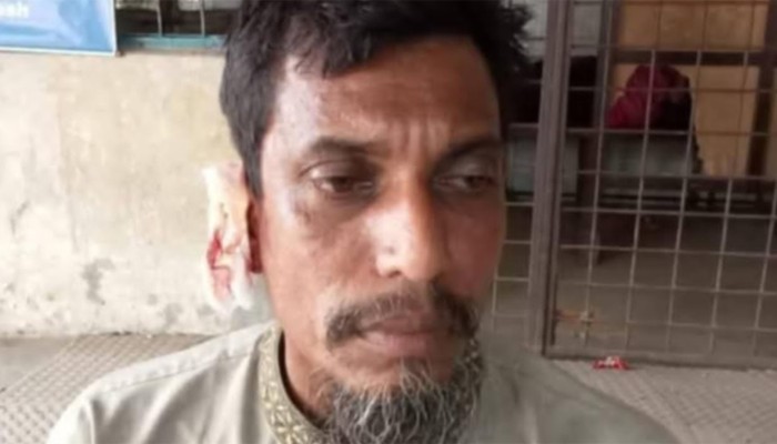 ​বাকিতে সিগারেট না পেয়ে কামড়ে কান ছিঁড়ে ফেলল যুবক