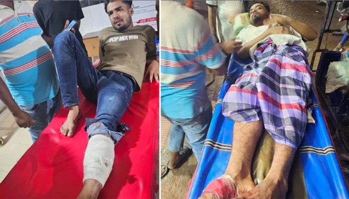 ​নোয়াখালীতে জামায়াতের ২ কর্মী গুলিবিদ্ধ