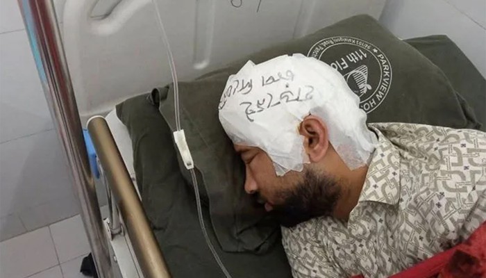 ​মামুনের খুলি ফ্রিজে, মাথায় লেখা ‘হাড় নেই, চাপ দিবেন না’