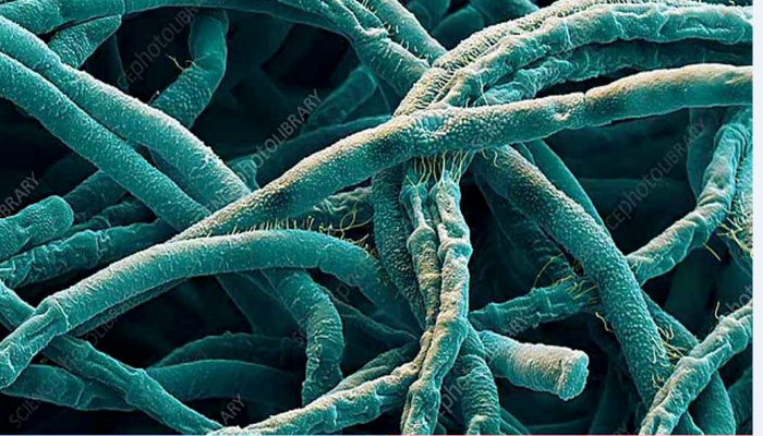 ​অ্যানথ্রাক্সে আক্রান্ত অর্ধশত মানুষ