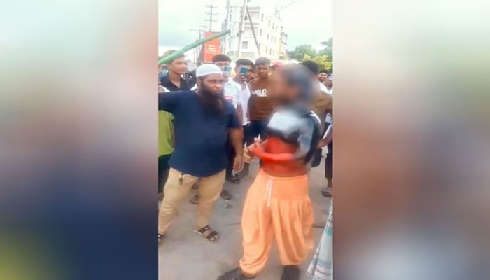 ​চুরির অপবাদে হোটেলকর্মীর চুল কেটে শরীরে পোড়া মবিল ঢেলে নির্যাতন