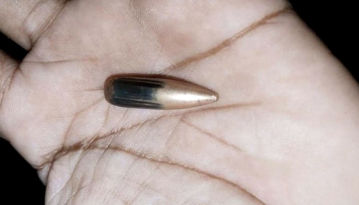 ​মিয়ানমার থেকে ছোড়া গুলিতে টেকনাফে নারী আহত