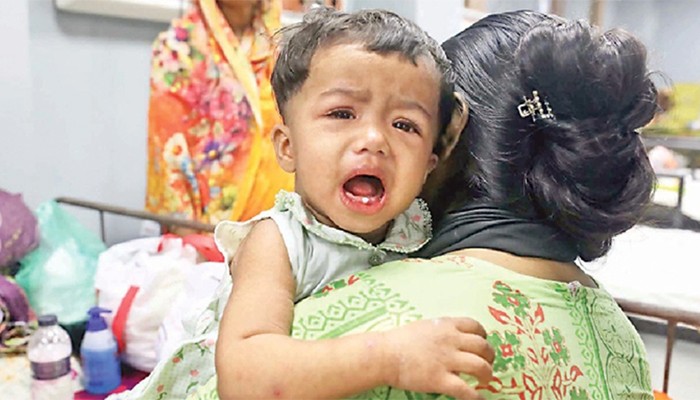 ​হাম: আরও ৩ শিশুর মৃত্যু