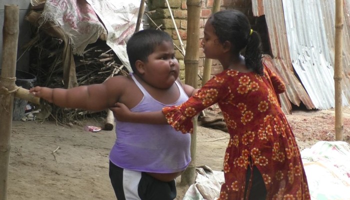 ৪ বছরের শিশুর ওজন যখন ৫২ কেজি!