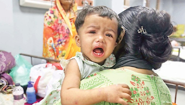 ​হাম উপসর্গে আরও চার মৃত্যু
