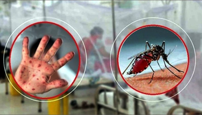 একদিনে হাম ও ডেঙ্গুতে ৯ মৃত্যু