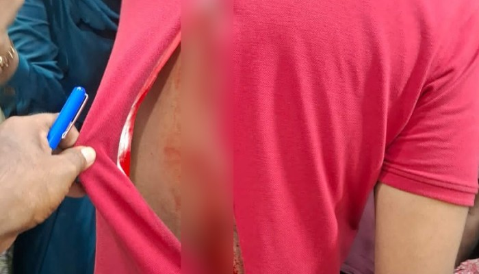 রাজধানীতে পুলিশ কর্মকর্তাকে ছুরিকাঘাত