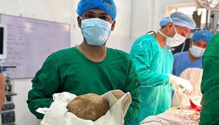 মূত্রথলি থেকে বের করা হল ৩.১ কেজি ওজনের পাথর