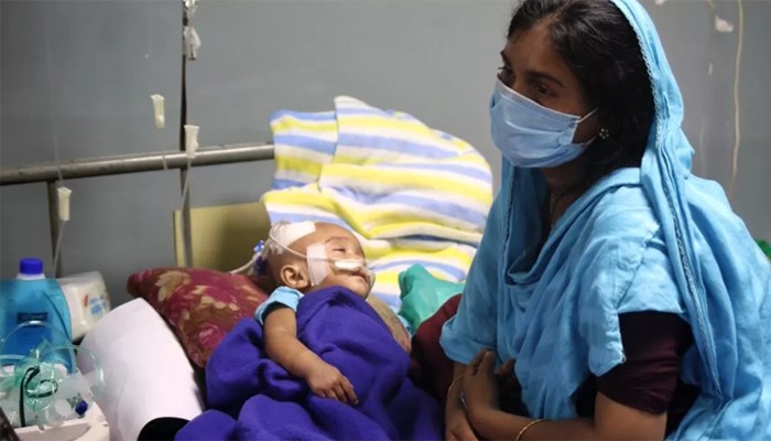 ​হামের উপসর্গে ২৪ ঘণ্টায় আরও তিন শিশুর মৃত্যু