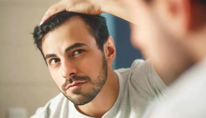 ​খুশকি দূর করার ঘরোয়া উপায়